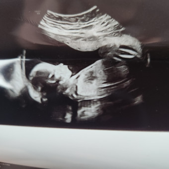 Mallory & Ryan's Baby Registry Photo.