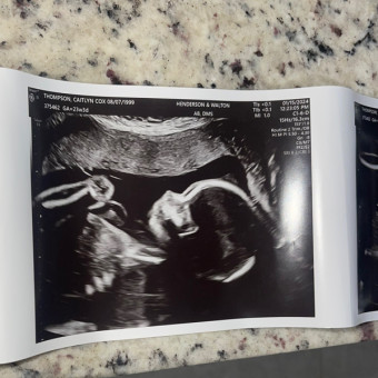 Caitlyn's Baby Registry Photo.