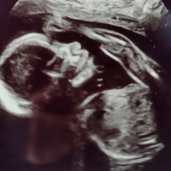 Alia's Baby Registry Photo.