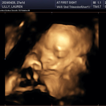Babylist Registry Photo