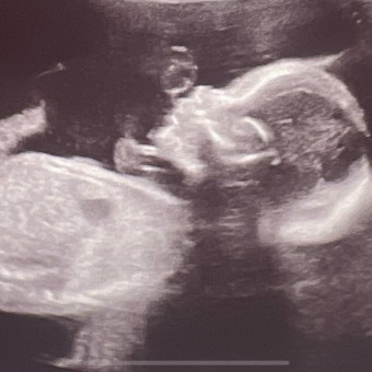 Baby Lindsey Fournell Photo.