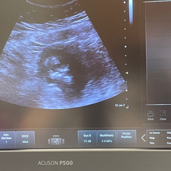 Allyssa's Baby Registry Photo.