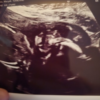 Maryah's Baby Registry Photo.