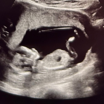 Baby Shapiro’s Registry Photo.