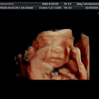 Babylist Registry Photo