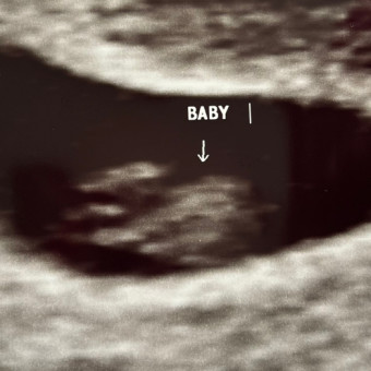 Arin's Baby Registry Photo.