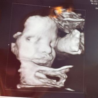 Camryn's Baby Registry Photo.