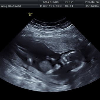 Hailey Wing and Blake Haywood’s Baby Registry at Babylist