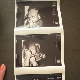 Aleigha's Baby Registry Photo.