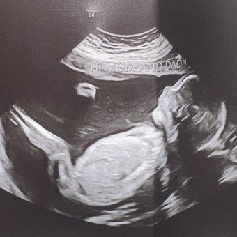 Breanna's Baby Registry Photo.
