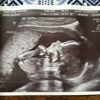 Babylist Registry Photo