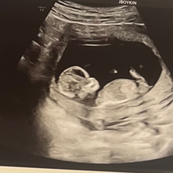 Madison's Baby Registry Photo.