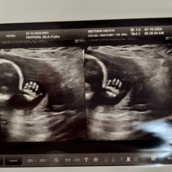 Babylist Registry Photo
