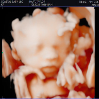 Babylist Registry Photo