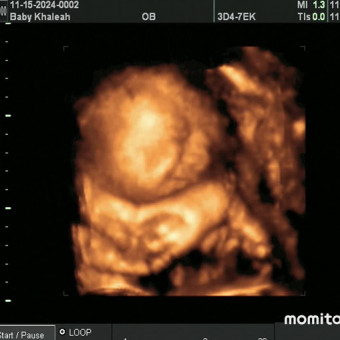 Babylist Registry Photo