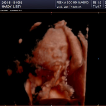 Babylist Registry Photo