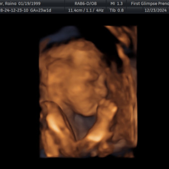 Babylist Registry Photo
