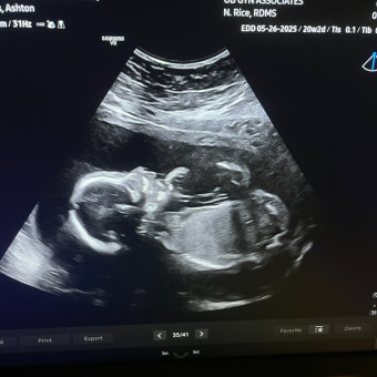 Babylist Registry Photo