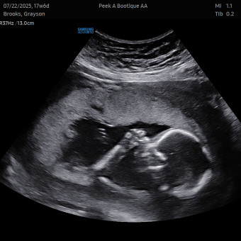 Babylist Registry Photo