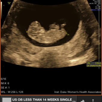 Babylist Registry Photo