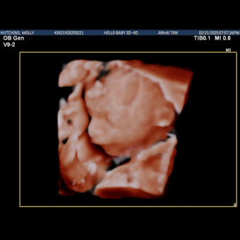 Babylist Registry Photo