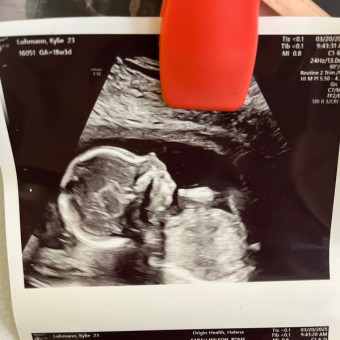 Babylist Registry Photo