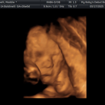 Babylist Registry Photo