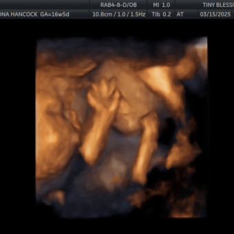 Babylist Registry Photo