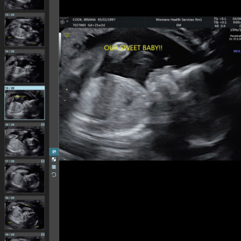 Babylist Registry Photo
