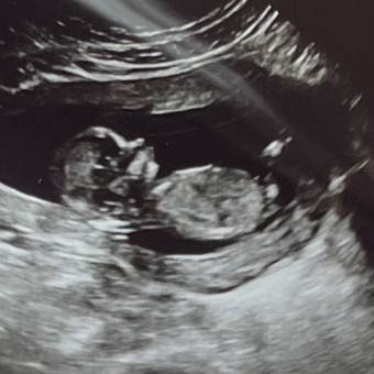 Megan and Matthew Macholz's Baby Registry at Babylist