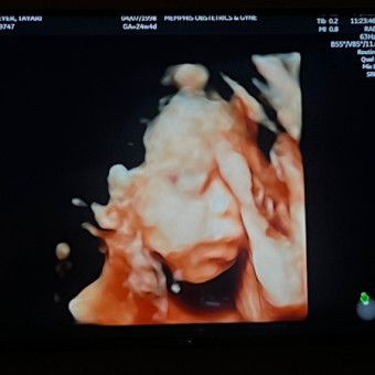 Babylist Registry Photo