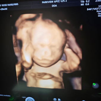 Babylist Registry Photo