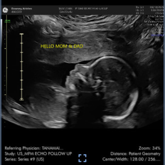 Babylist Registry Photo