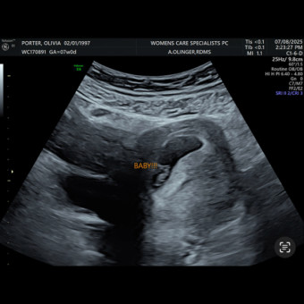Babylist Registry Photo