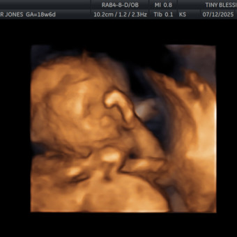 Babylist Registry Photo