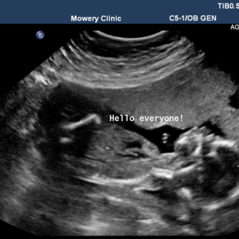 Babylist Registry Photo
