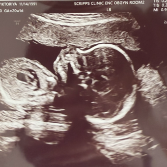 Babylist Registry Photo