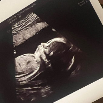 Sarah and Stephanie Sztropkalyi's Baby Registry at Babylist