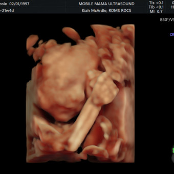 Babylist Registry Photo