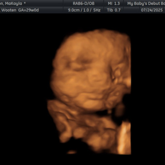 Babylist Registry Photo