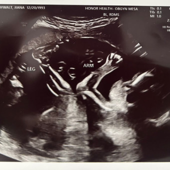Babylist Registry Photo