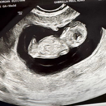 Morgan and Kevin Kendrick's Baby Registry at Babylist