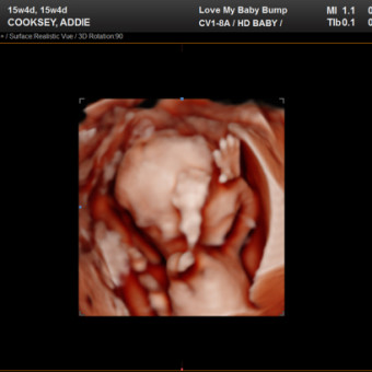 Babylist Registry Photo