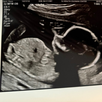 Babylist Registry Photo