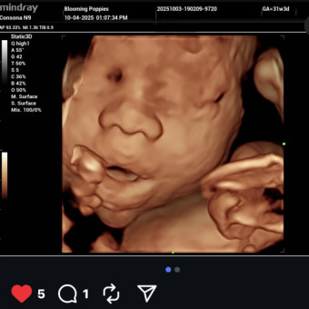 Babylist Registry Photo