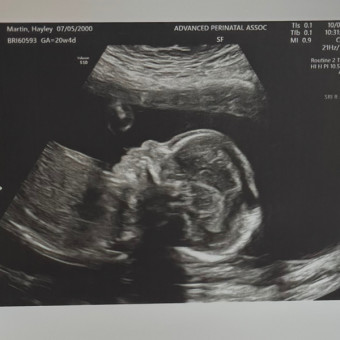 Babylist Registry Photo