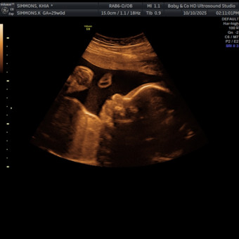 Babylist Registry Photo