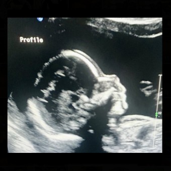 BABY☆ページ HEXA 3X - Baby Strollers & Gear Designed to Fit Your Life