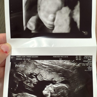 Babylist Registry Photo