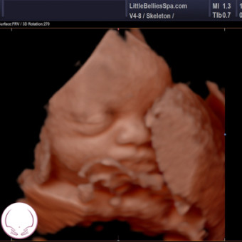 Babylist Registry Photo